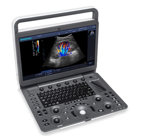 Ekonomik Portable Doppler Ultrasonografi Sistemleri
